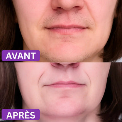 Abelline Pro : Une peau nette. En 2 minutes. À la maison.